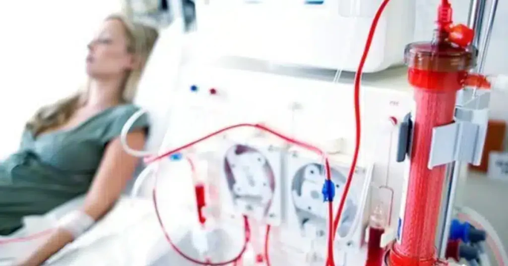 tomar El AOVE para pacientes en hemodiálisis